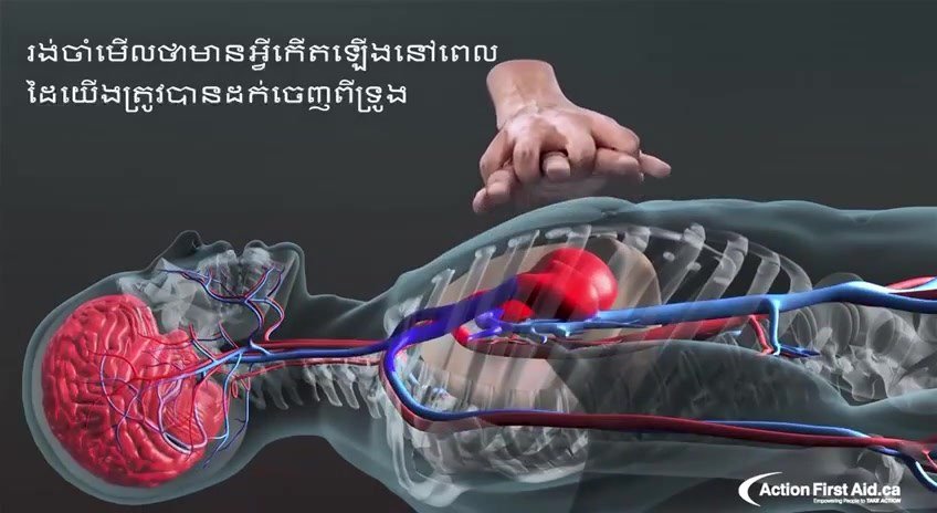 VIVEST — CPR & AED video manual (Khmer)